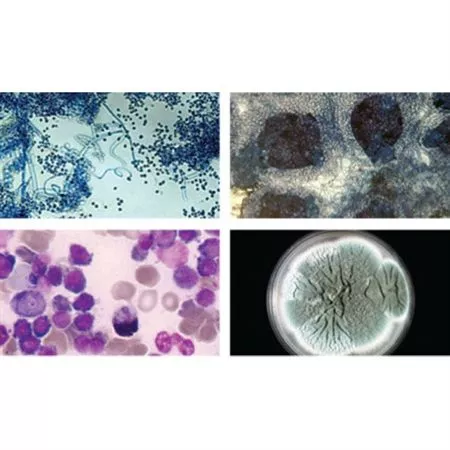 Bacteriology Image Atlas Single-User