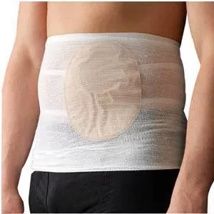 CareFix StomaSafe Classic Ostomy Support Garment Large/X