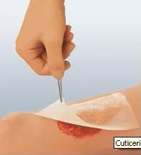 Cuticerin Oil Emulsion Impregnated Dressing, 3 x 8 Inch