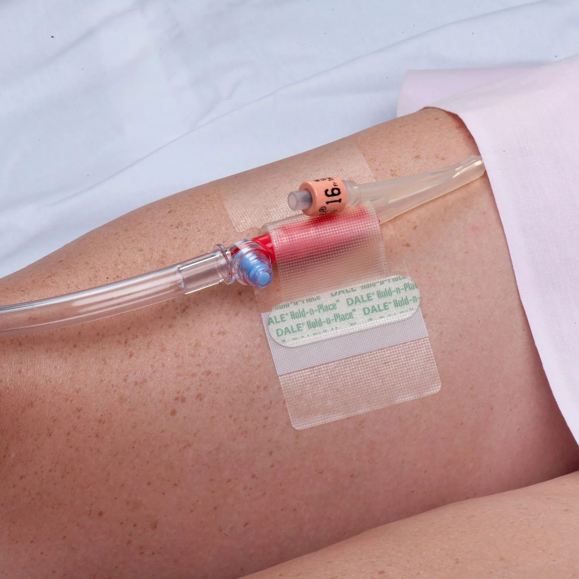 Dale Hold-n-Place Catheter Holder