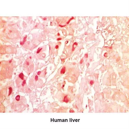 Hepatitis B Stain Kit Hepatitis B Control Slides