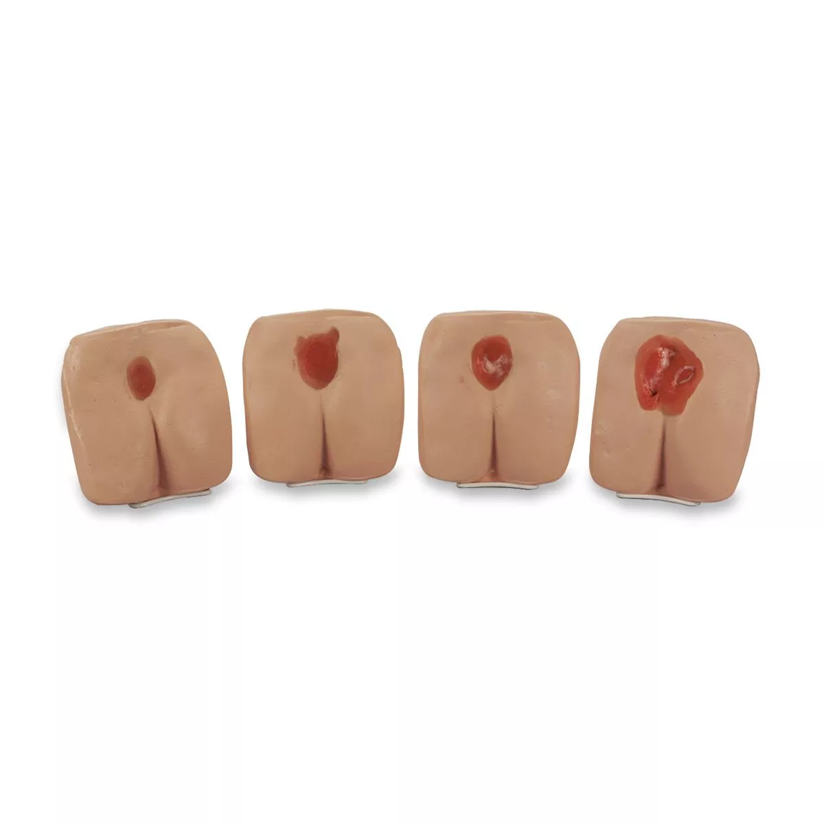 Life/Form Pressure Ulcer/Bedsore Models