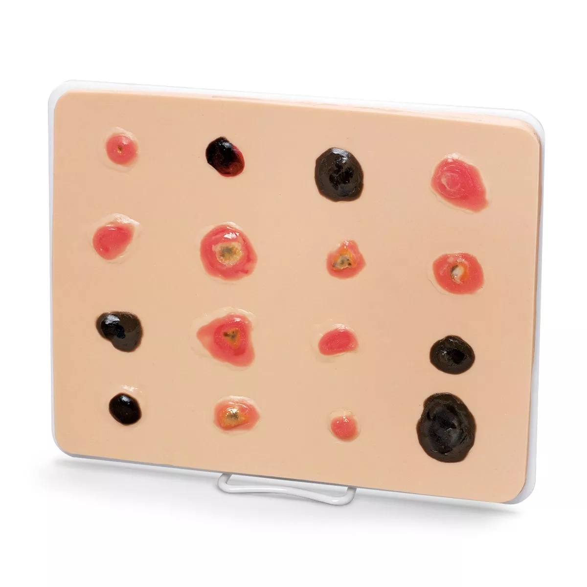 Life/form Skin Cancer Trainer - Enlarged