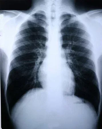 McKesson Clear Choice Performance Medical X-ray Film