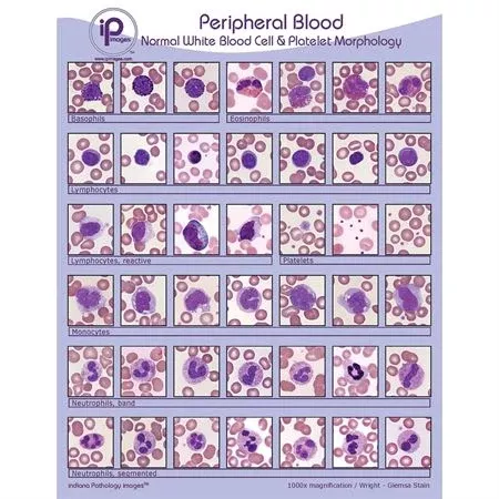 Peripheral Blood Cards Normal White Blood Cell & Platelet Morphology Binder