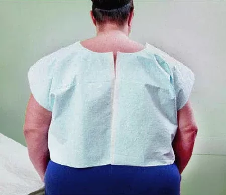 Tidi Products Exam Cape Tidi Blue X-Large Front / Back Opening Without Closure Unisex - M-983945-3692 - Case of 100