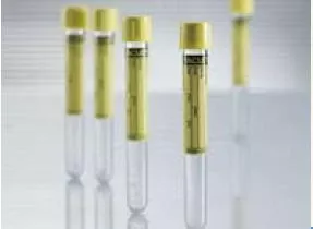 Vacuette Urinalysis Tube, 6 mL, 13 x 100 mm