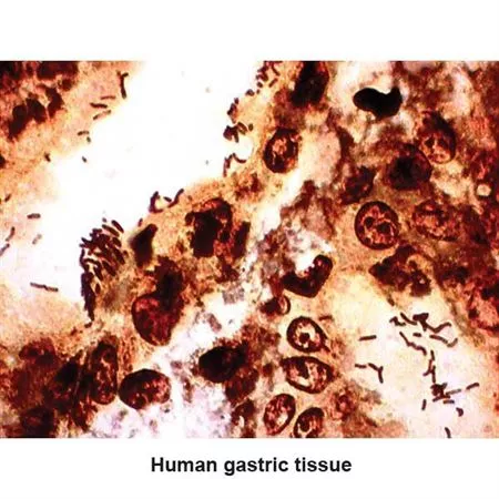 Warthin-Starry Stain Kit Legionella Pneumophila Control Slides